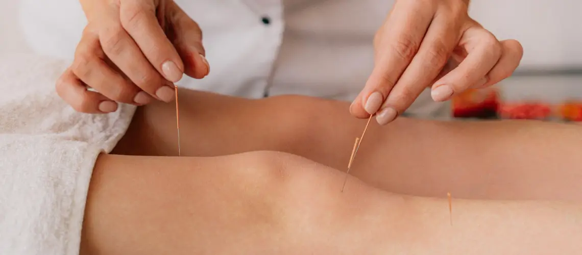 A person receiving acupuncture treatment, representing alternative health